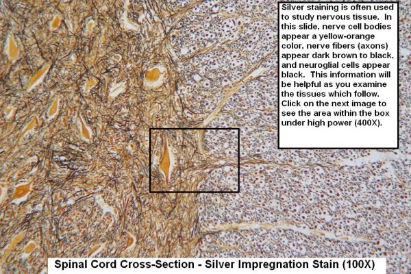 O – Spinal Cord Silver Stain 100X