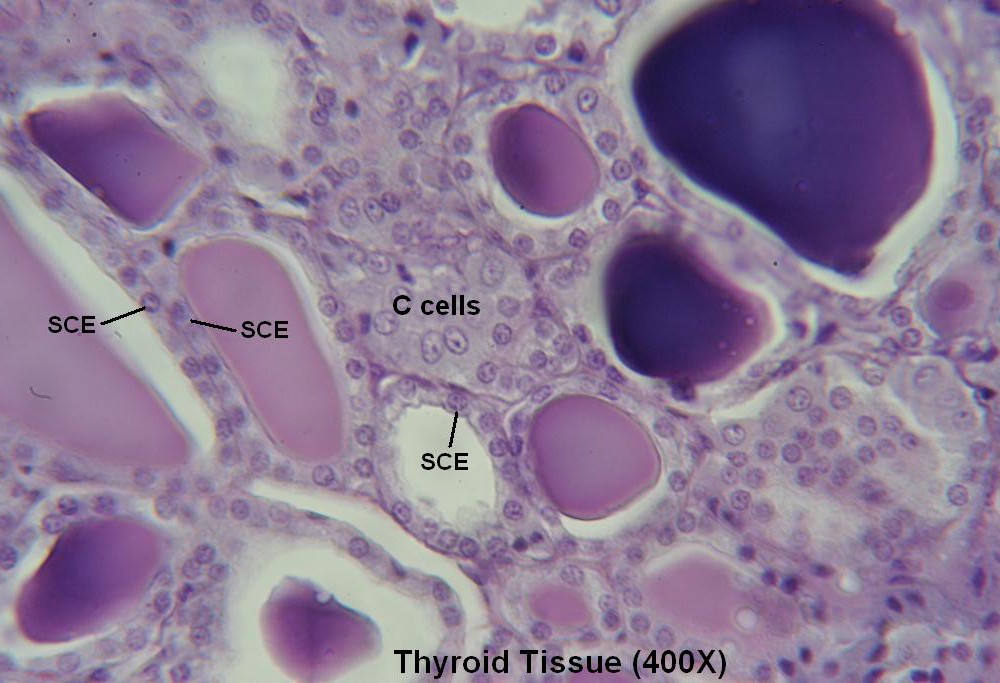P-Thyroid-Tissue 400X 3