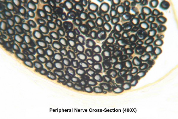 Peripheral Nerve X-Section 400X