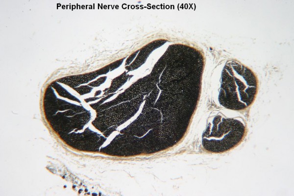 Peripheral Nerve X-Section 40X