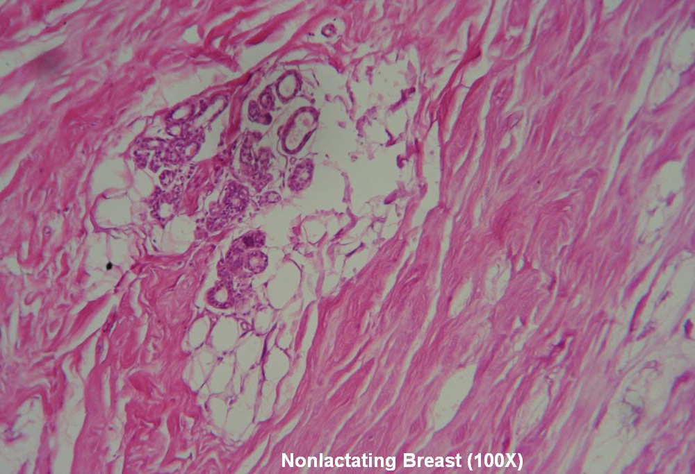 Q – Nonlactating Breast 100X 4