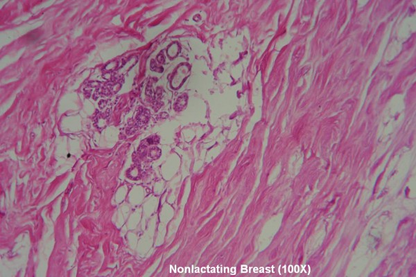 Q – Nonlactating Breast 100X 4