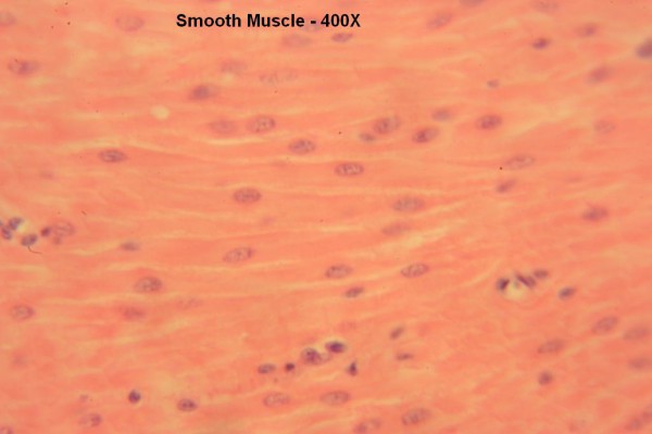 Q Smooth Muscle 400x 11
