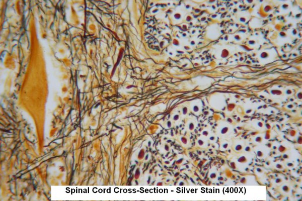 Q – Spinal Cord Silver Stain 400X 2