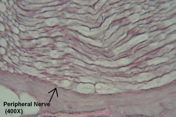 R – Peripheral Nerve 400X 2