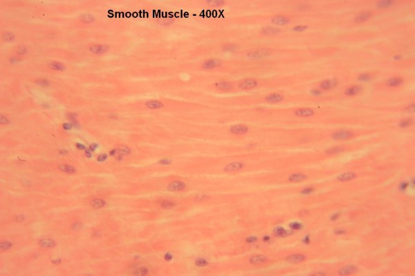 R Smooth Muscle 400x 12