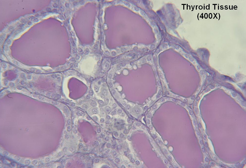R-Thyroid-Tissue 400X 5