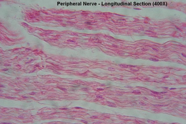 S – Peripheral Nerve – Long Section – Node of Ranvier 400X 4