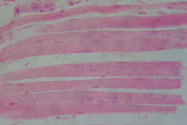 Skeletal Muscle Long Section 400x 8