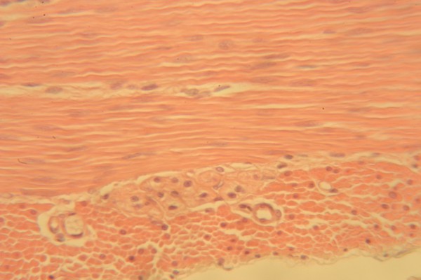 Smooth Muscle 400x 1