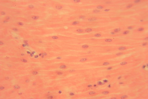 Smooth Muscle 400x 12