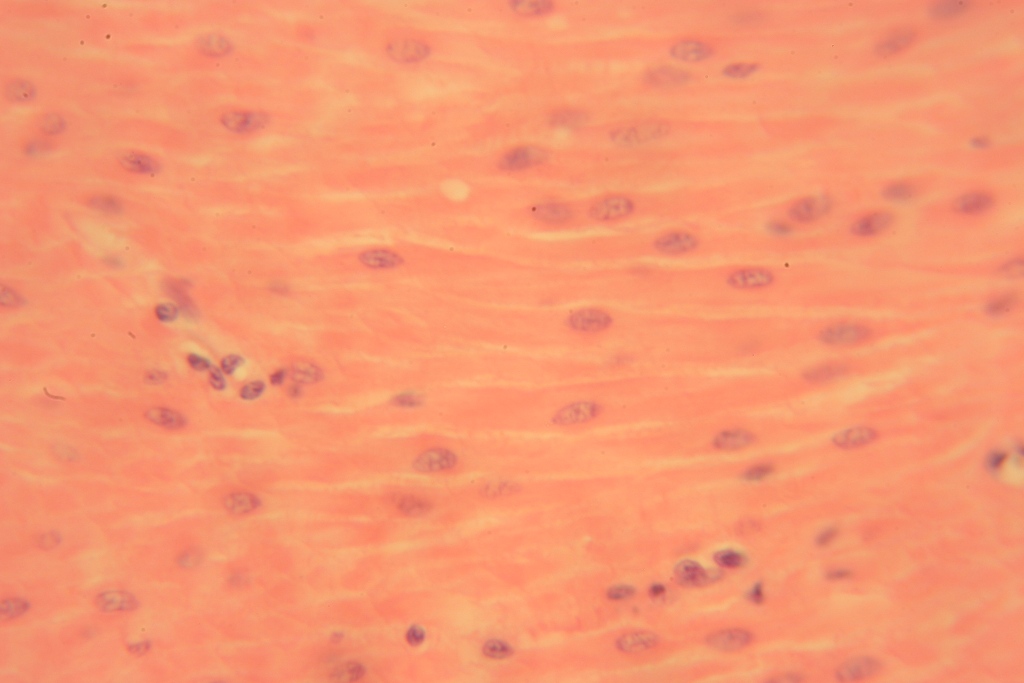 Smooth Muscle 400x 12