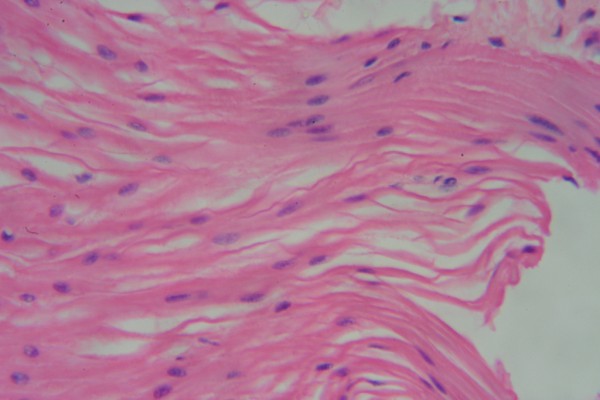 Smooth Muscle 400x 7