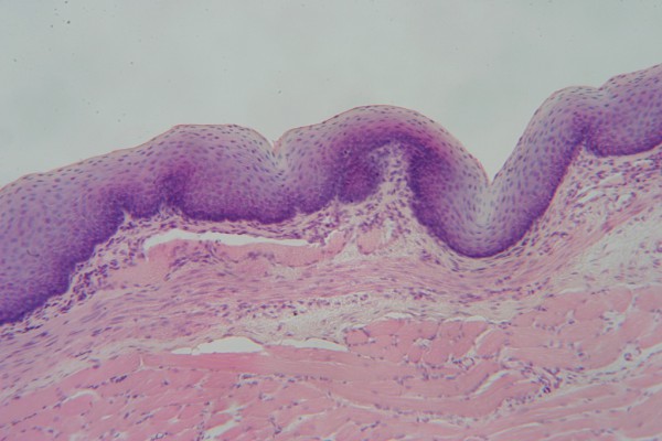 Stratified Squamous 100x 2