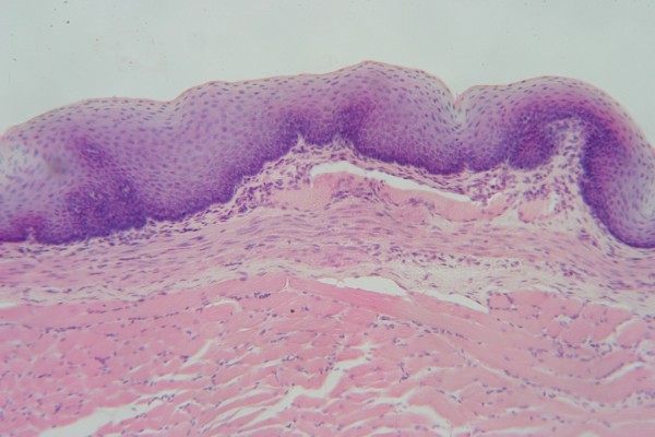 Stratified Squamous 100x 3