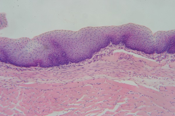 Stratified Squamous 100x 4