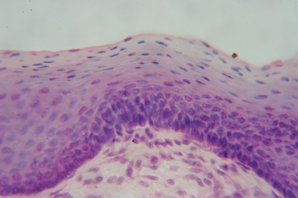 Stratified Squamous 400x 1