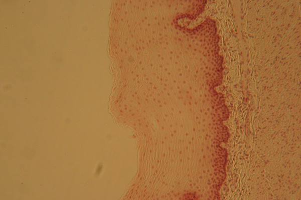 Stratified Squamous 400x 4