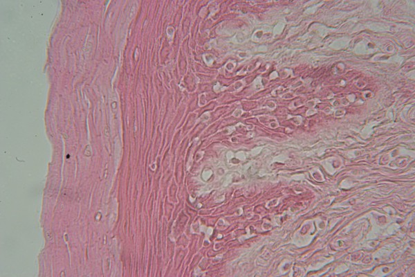 Stratified Squamous 400x 7