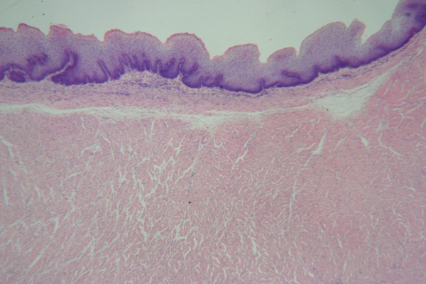 Stratified Squamous 40x 1