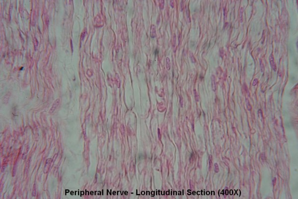 T – Peripheral Nerve – Long Section – Node of Ranvier 400X 5