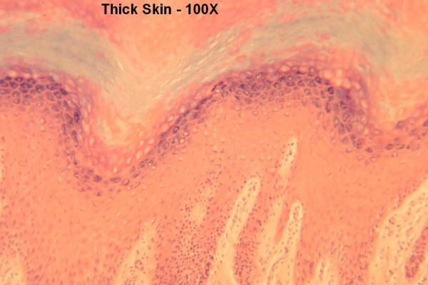 Thick Skin 100X