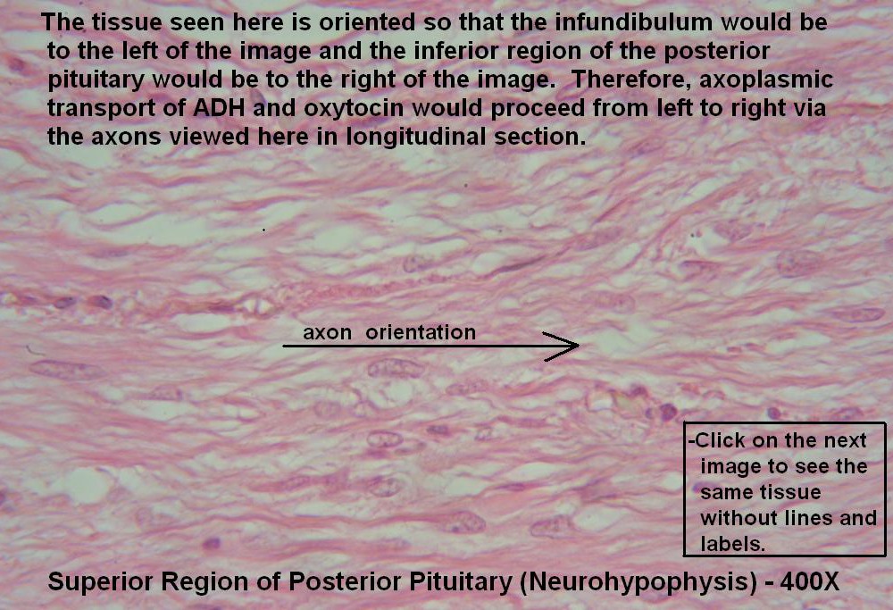 Y – Pituitary Gland 400X Posterior Pit 4