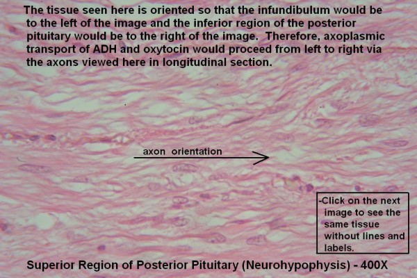 Y – Pituitary Gland 400X Posterior Pit 4
