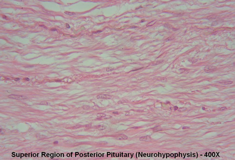 Z – Pituitary Gland 400X Posterior Pit 5