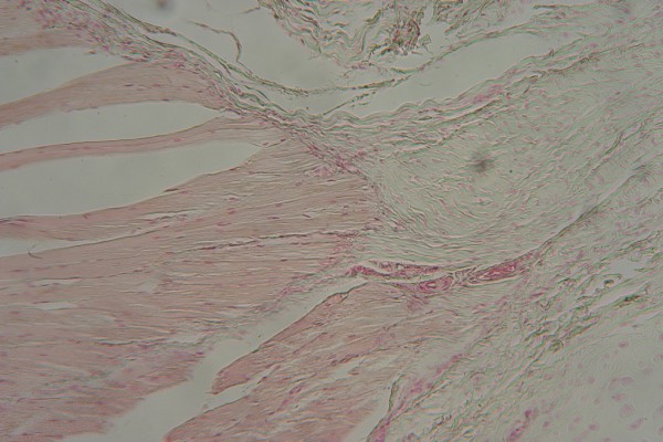 Muscle-Tendon Junction 100X 2