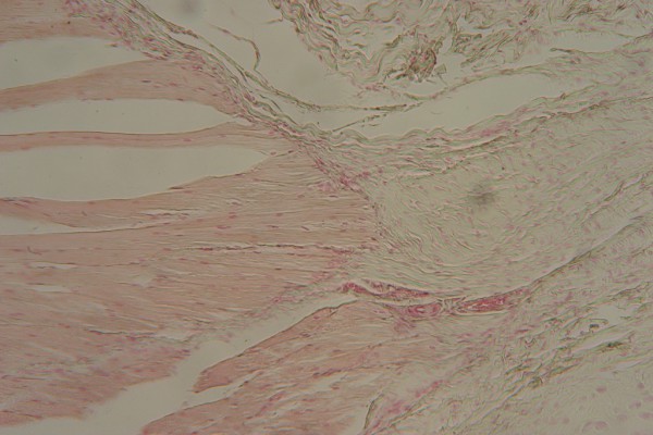 Muscle-Tendon Junction 100X 3