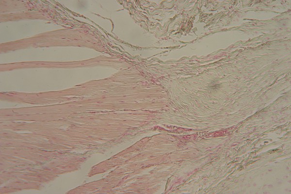 Muscle-Tendon Junction 100X 4