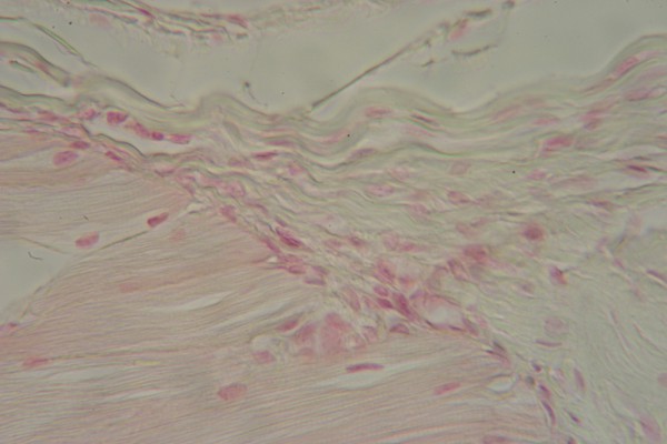Muscle-Tendon Junction 400X 2