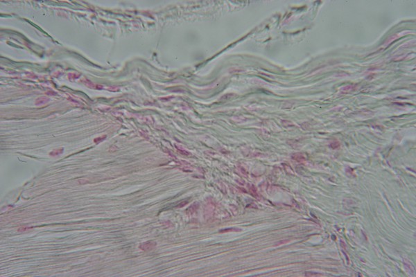 Muscle-Tendon Junction 400X 3