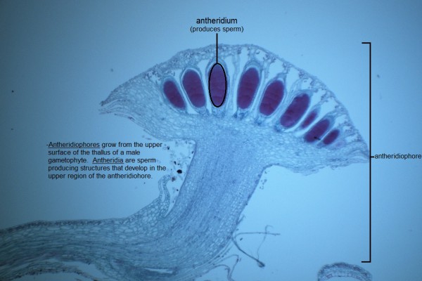 H Marchantia Antheridia 40X
