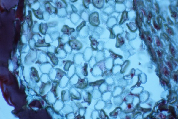 Male Cone Cross Section 400X C