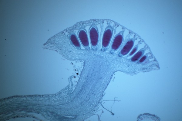 Marchantia antheridia 40X H