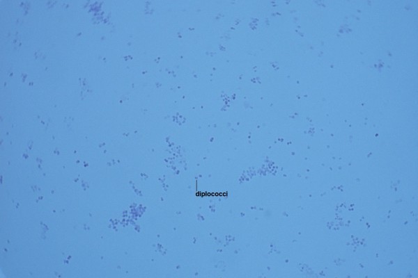 N-Neisseria meningitidis 1000X-1