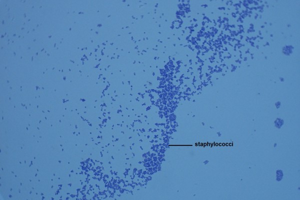 P-Staphylococcus aureus 1000X-1