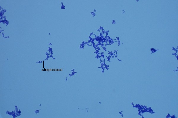 R-Streptococcus pyogenes 1000X-1