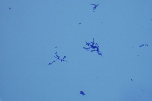 S-Streptococcus pyogenes 1000X-2