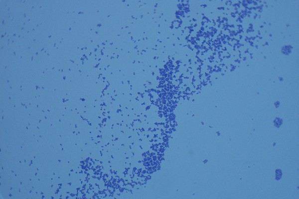 Staphylococcus aureus 1000X – P