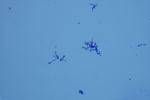Staphylococcus pyogenes 1000X – R