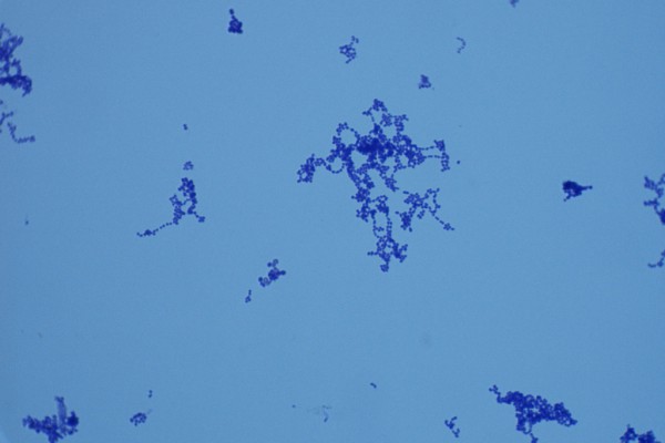 Staphylococcus pyogenes 1000X – S