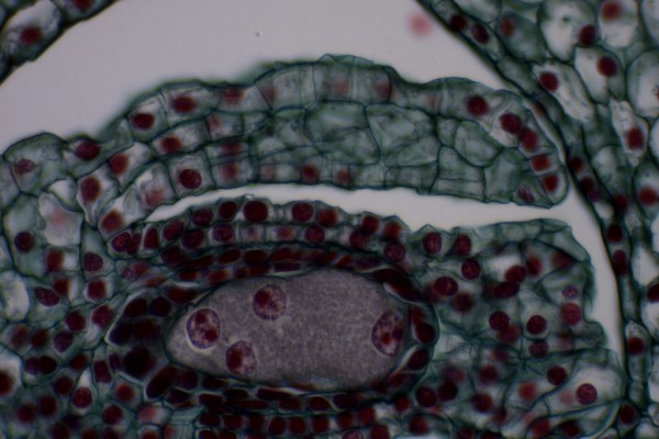 Lily Ovule 400X 1 I