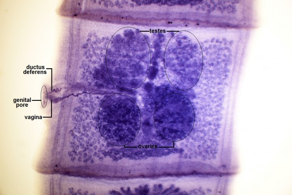 R- Tapeworm Proglottids 40X-4