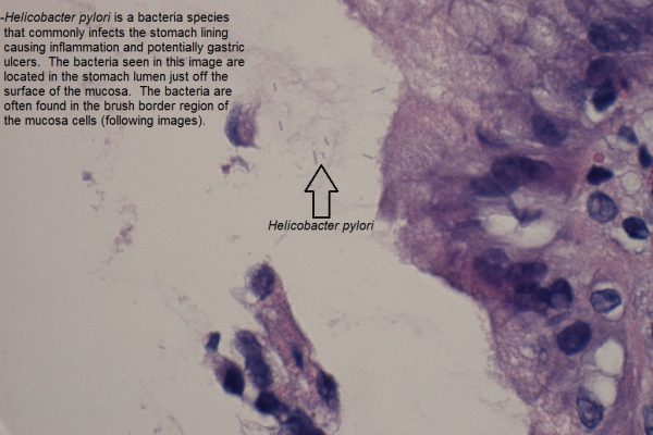 A – Helicobacter pylori – Gastric Mucosa – 1000X